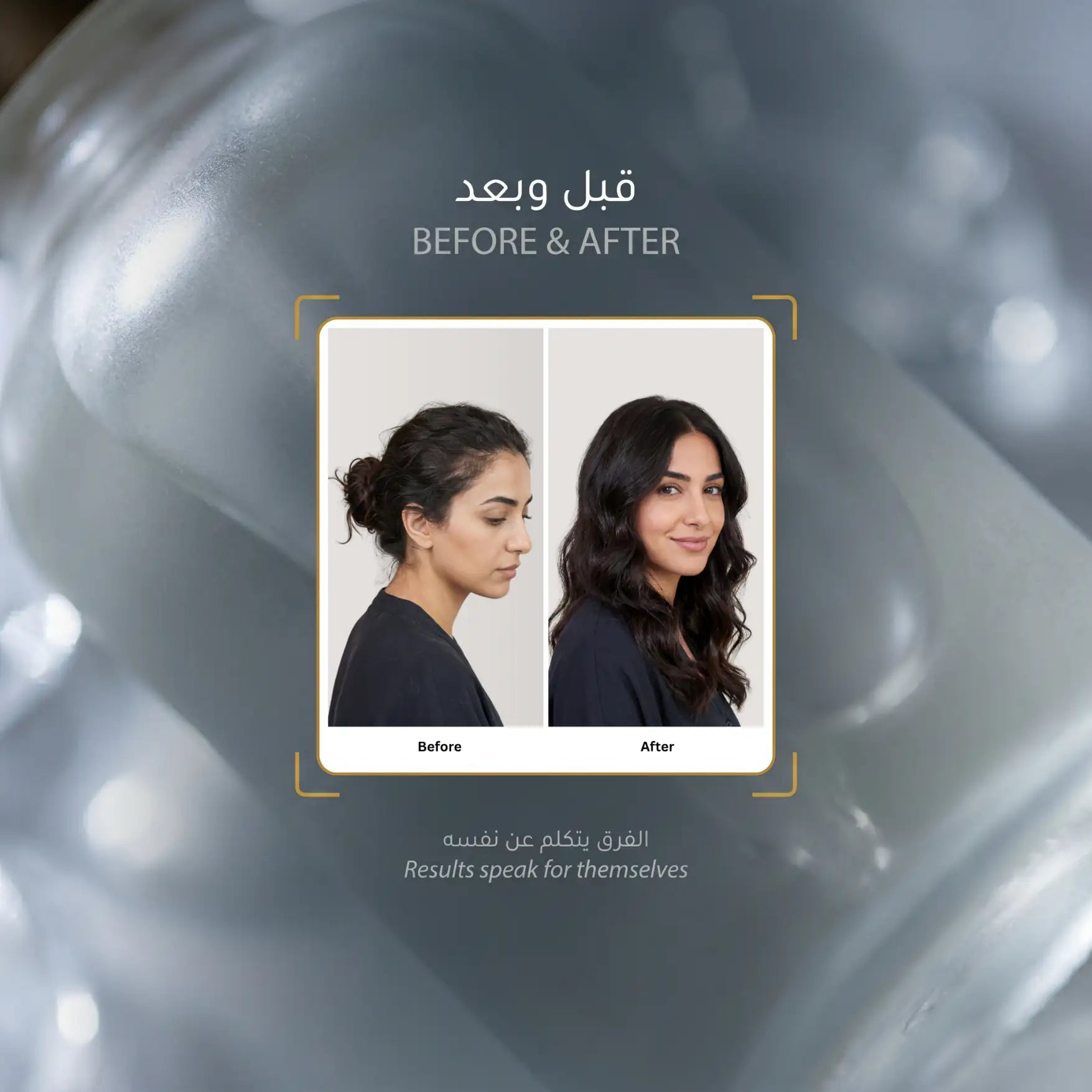 لومينيال 5 زيت الشعر بالمكونات التسعة